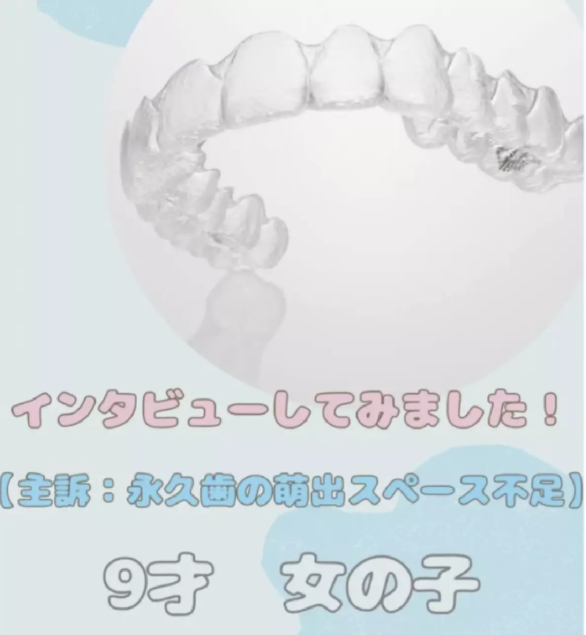 インビザライン感想