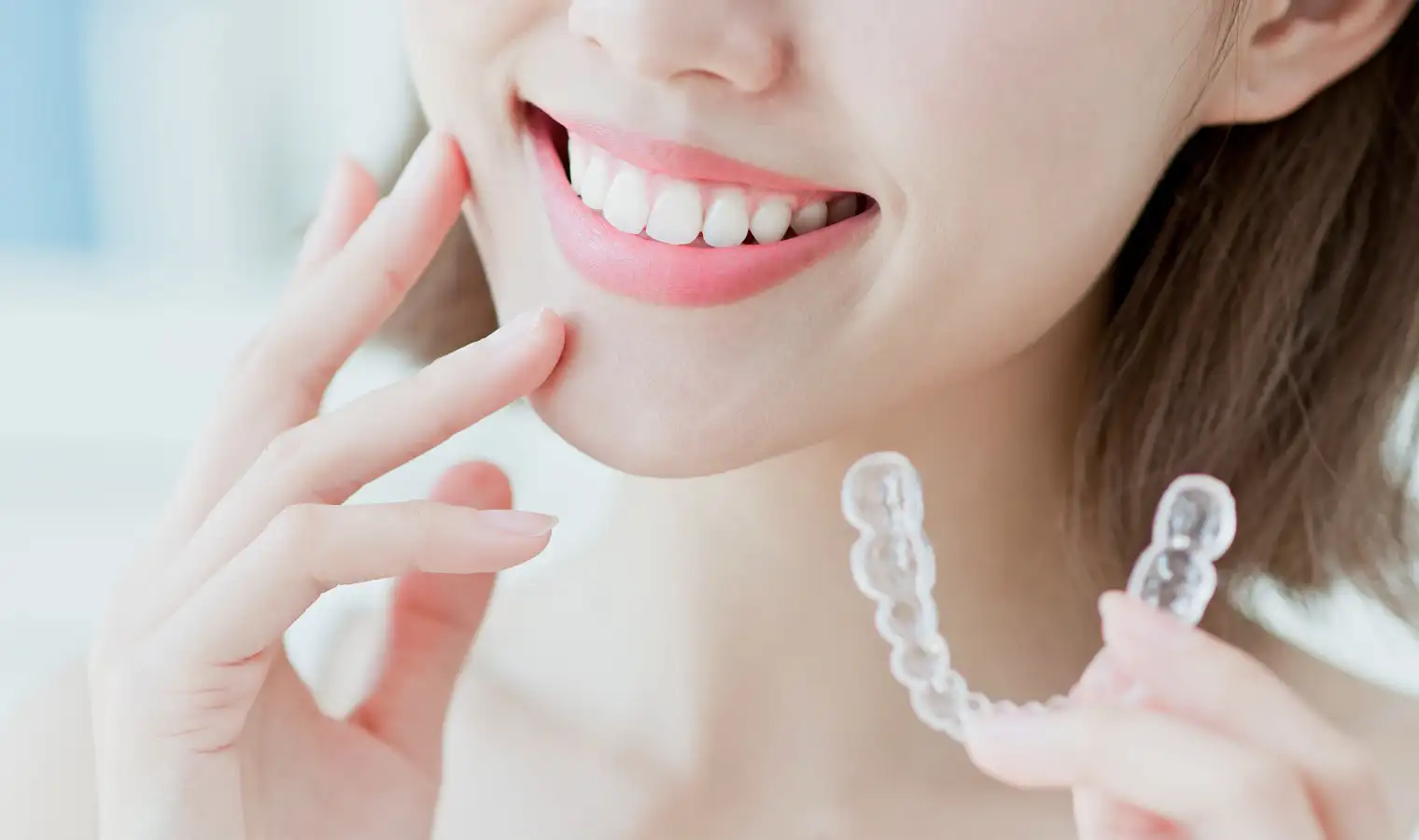 マウスピース矯正