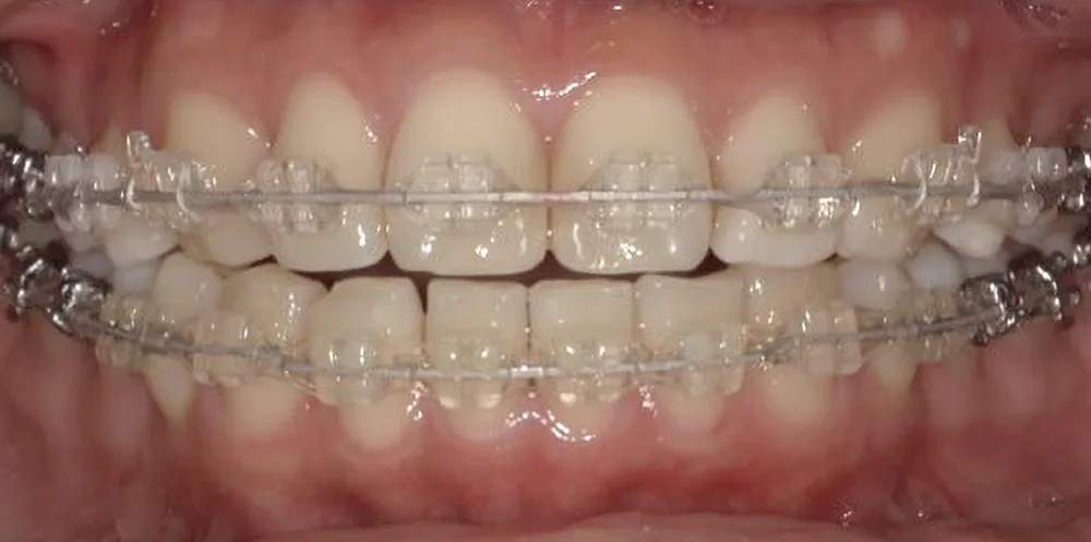 ホワイトワイヤー